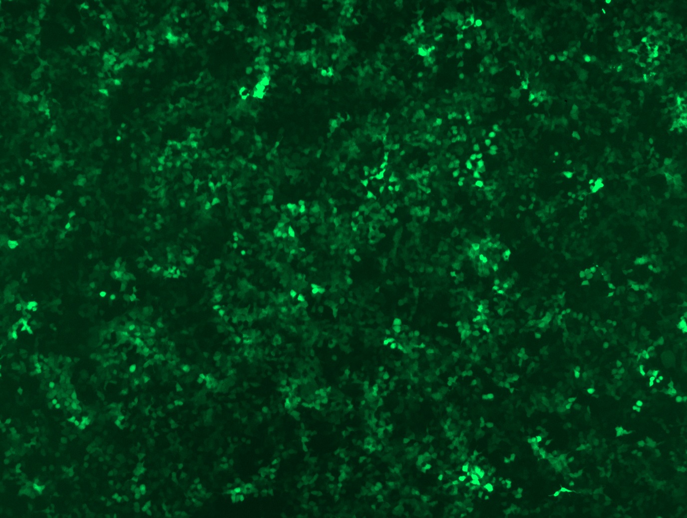 GFP signal was observed under microscope at 48 hours after transduction of TL503183A virus into HEK293 cells. TL503183A virus was prepared using lenti-shRNA TL503183A and TR30037 packaging kit.