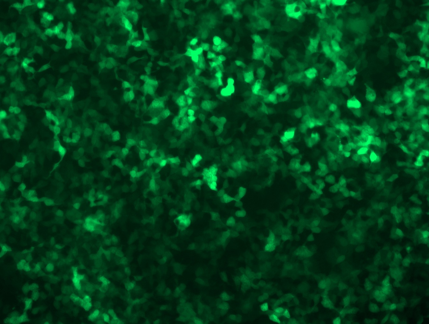 GFP signal was observed under microscope at 48 hours after transduction of TL507273A virus into HEK293 cells. TL507273A virus was prepared using lenti-shRNA TL507273A and TR30037 packaging kit.