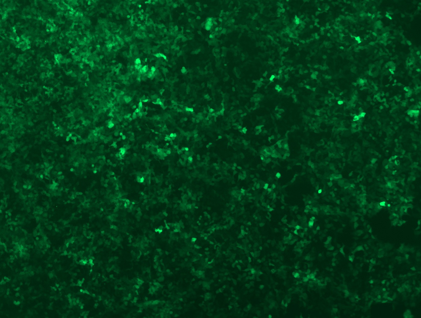 GFP signal was observed under microscope at 48 hours after transduction of TL507422B virus into HEK293 cells. TL507422B virus was prepared using lenti-shRNA TL507422B and TR30037 packaging kit.