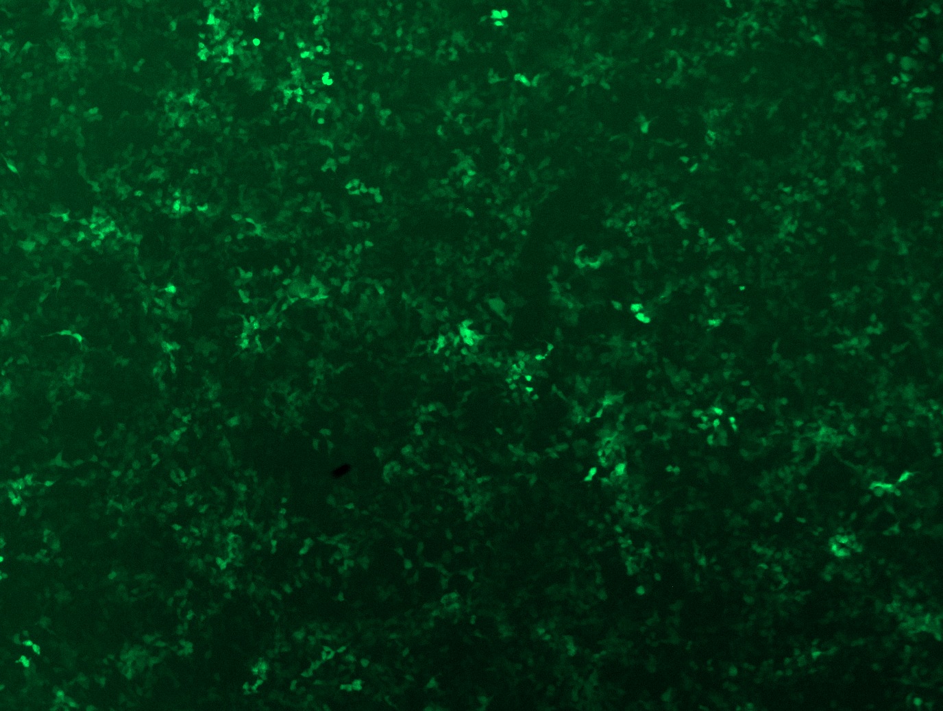 GFP signal was observed under microscope at 48 hours after transduction of TL514508A virus into HEK293 cells. TL514508A virus was prepared using lenti-shRNA TL514508A and TR30037 packaging kit.