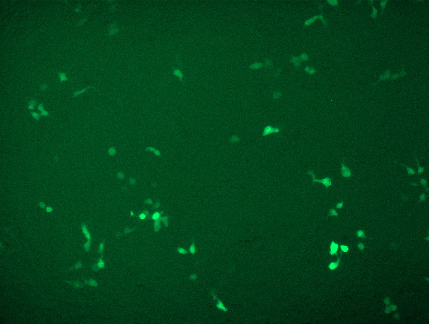 GFP signal was observed under microscope at 48 hours after transduction of TL300029A virus into HEK293 cells. TL300029A virus was prepared using lenti-shRNA TL300029A and TR30037 packaging kit.
