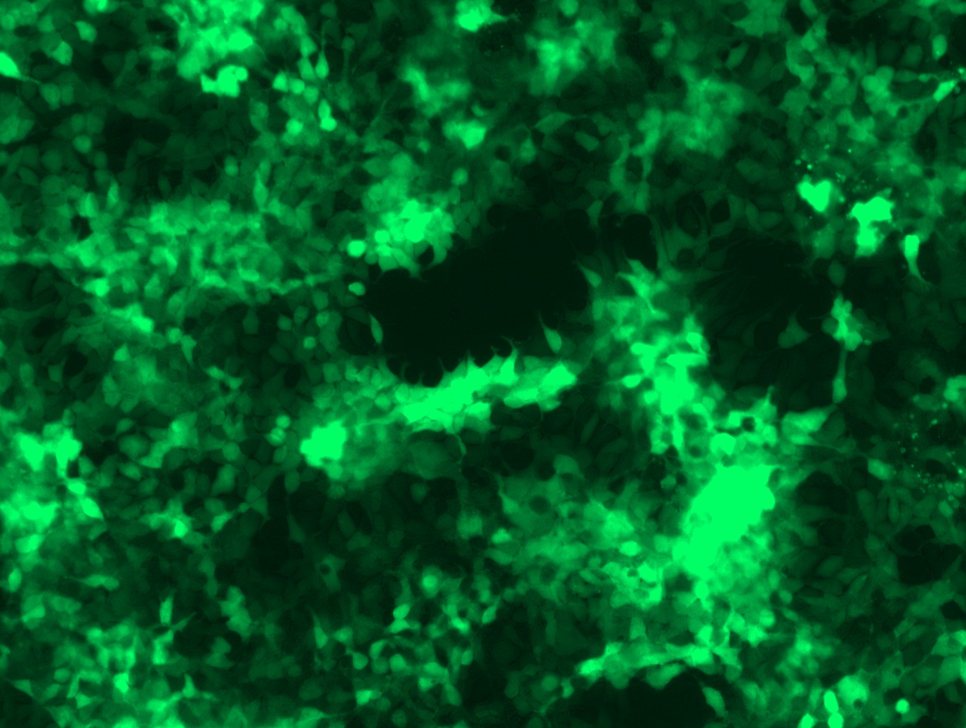 GFP signal was observed under microscope at 48 hours after transduction of TL303203A virus into HEK293 cells. TL303203A virus was prepared using lenti-shRNA TL303203A and TR30037 packaging kit.