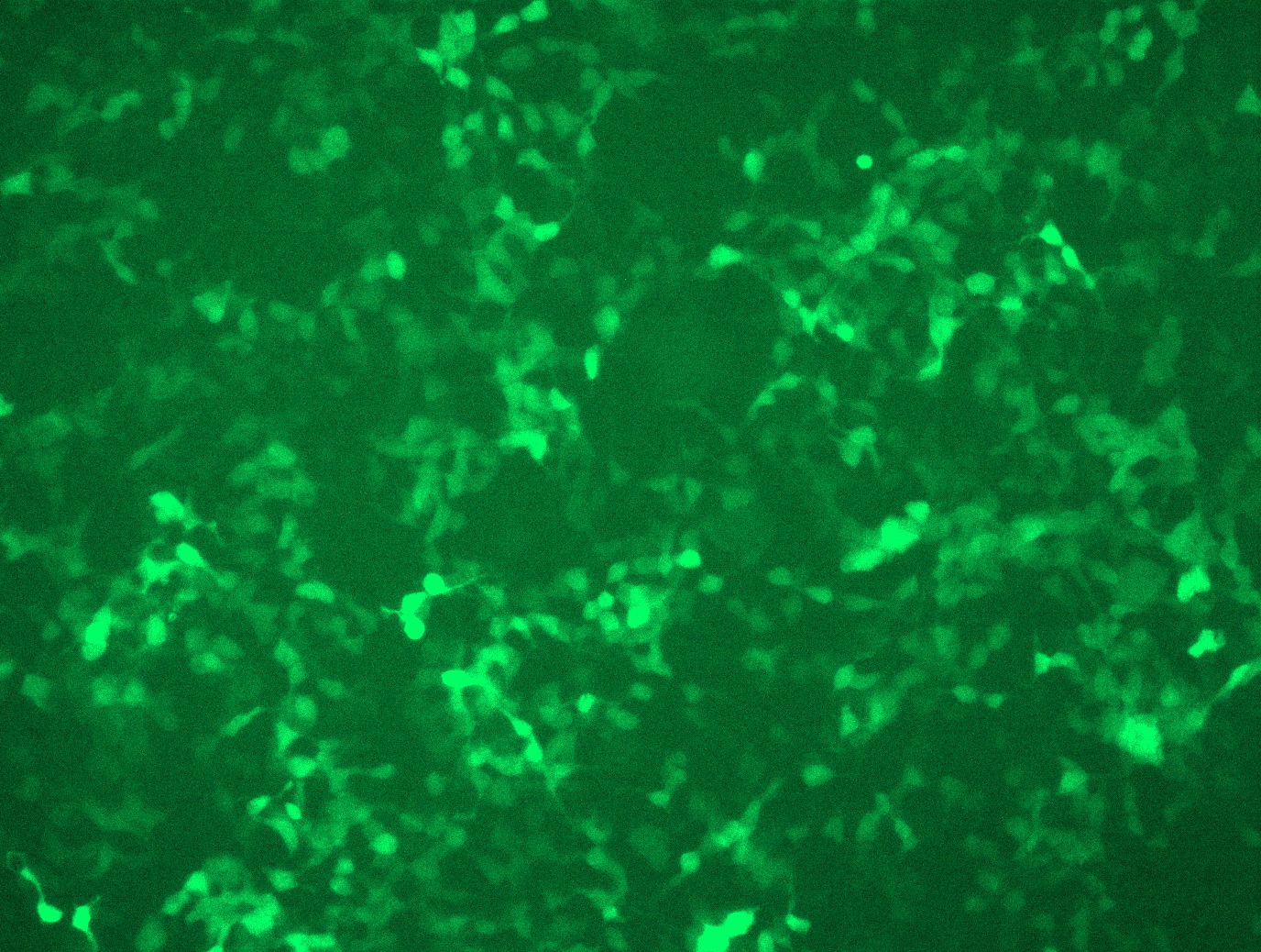 GFP signal was observed under microscope at 48 hours after transduction of TL309947A virus into HEK293 cells. TL309947A virus was prepared using lenti-shRNA TL309947A and TR30037 packaging kit.