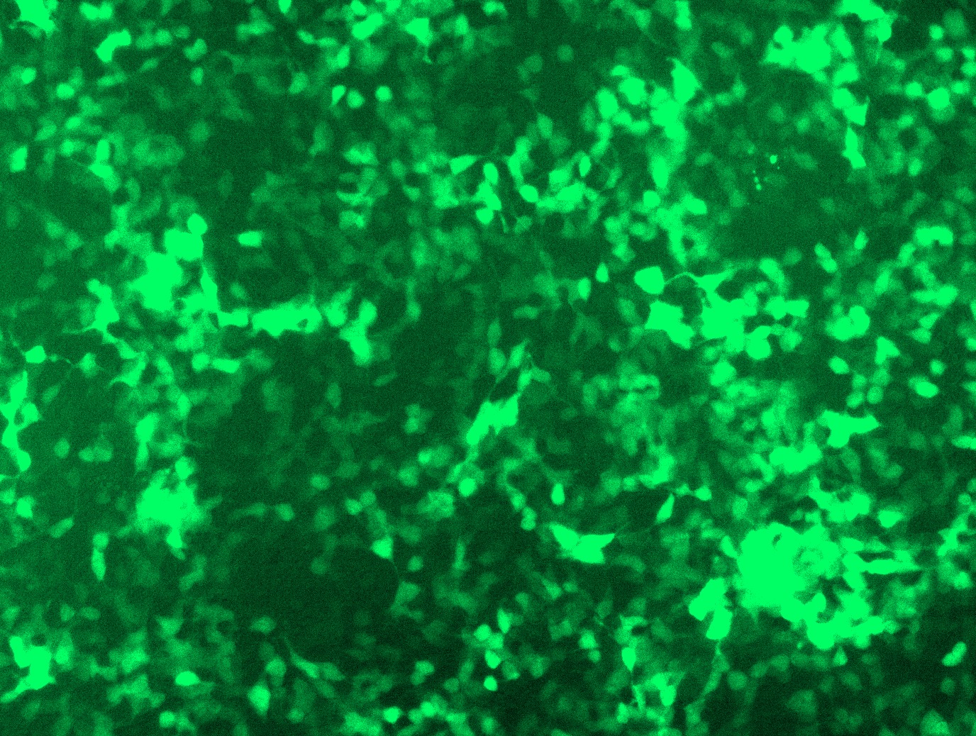 GFP signal was observed under microscope at 48 hours after transduction of TL509695A virus into HEK293 cells. TL509695A virus was prepared using lenti-shRNA TL509695A and TR30037 packaging kit.