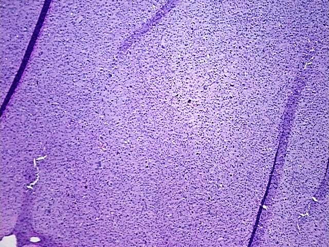 4x Image