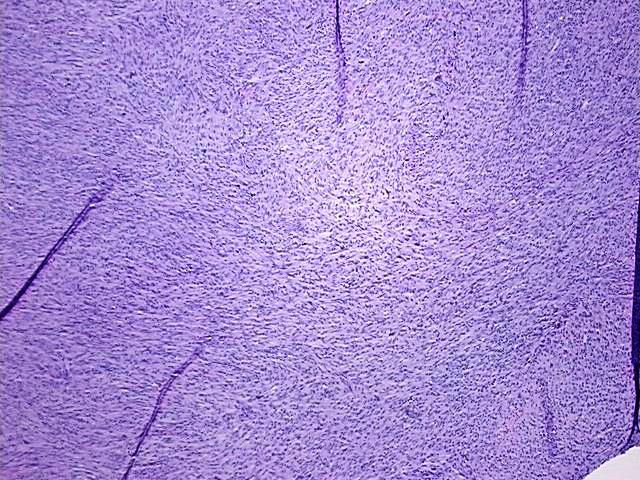 4x Image