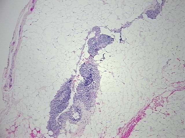 4x Image