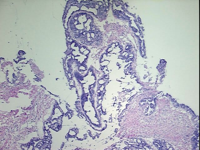 4x Image