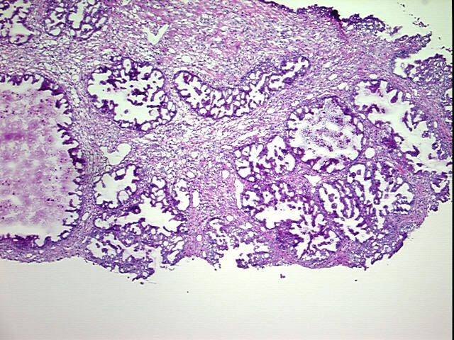 4x Image