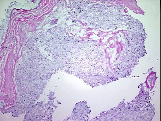 4x Image