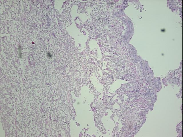 4x Image