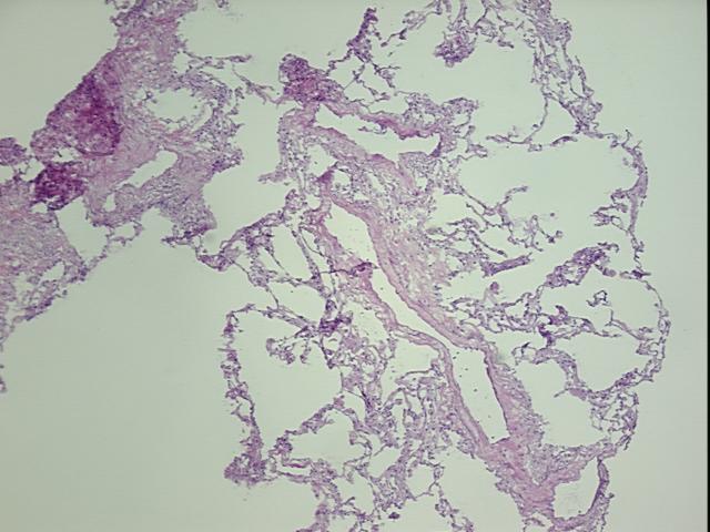 4x Image