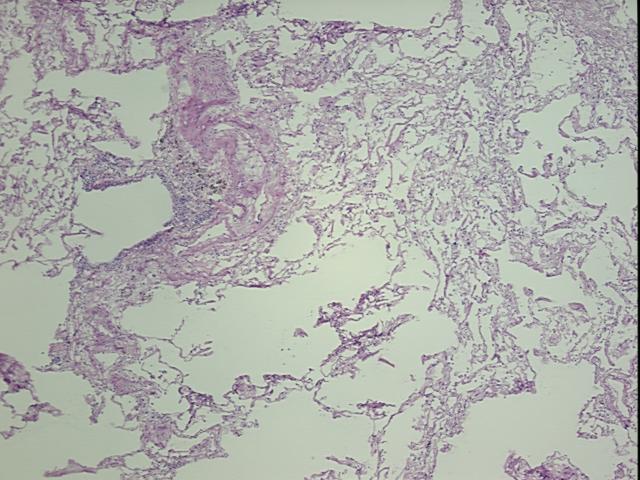 4x Image