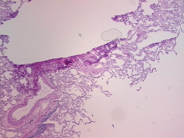 4x Image