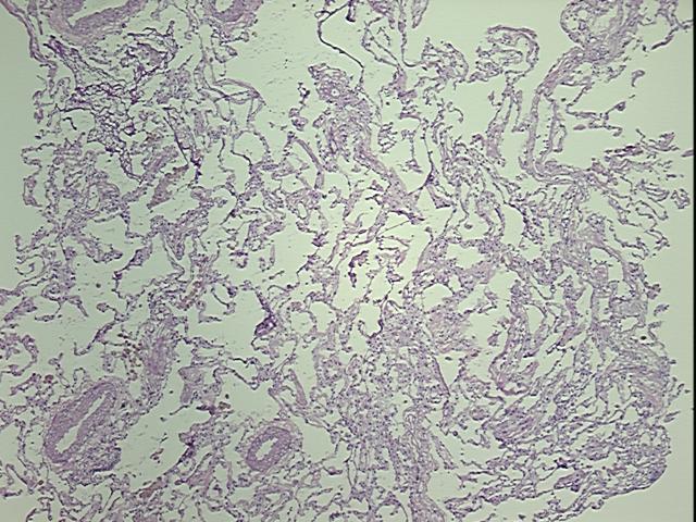 4x Image