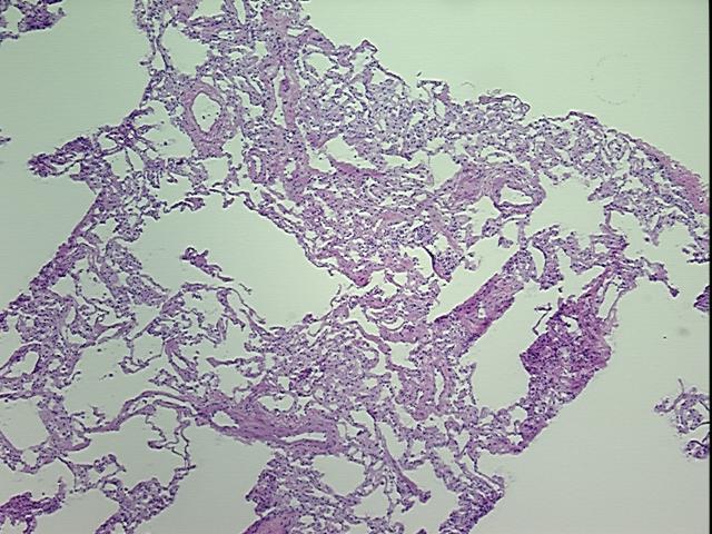 4x Image