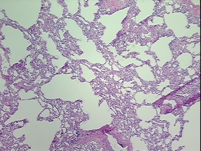 4x Image