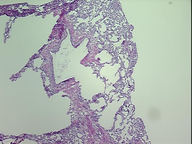 4x Image