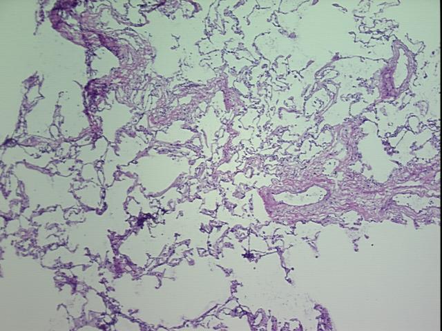 4x Image
