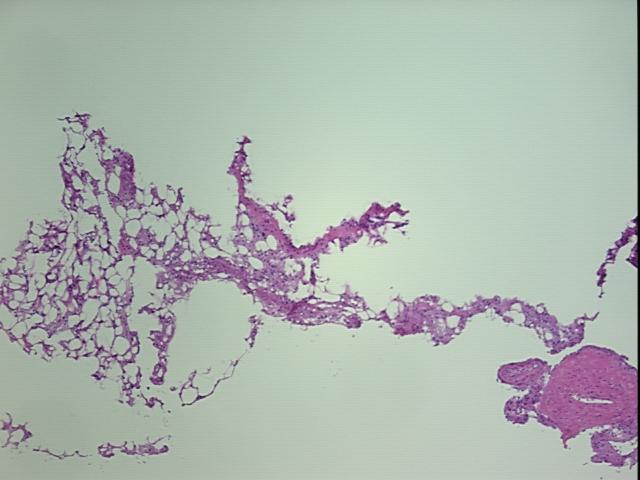 4x Image