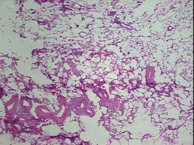 4x Image