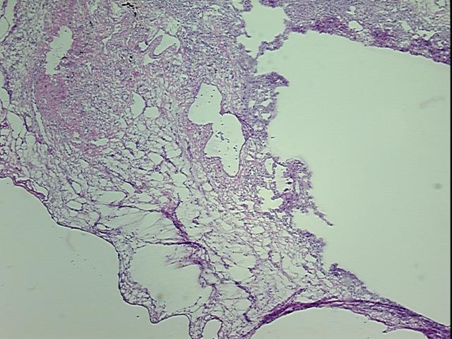 4x Image