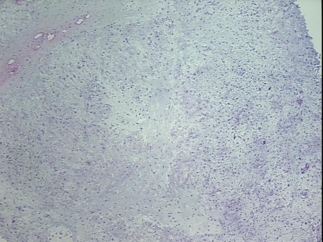 4x Image