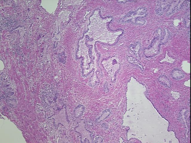 4x Image