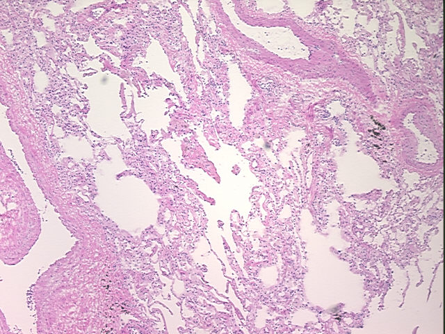4x Image