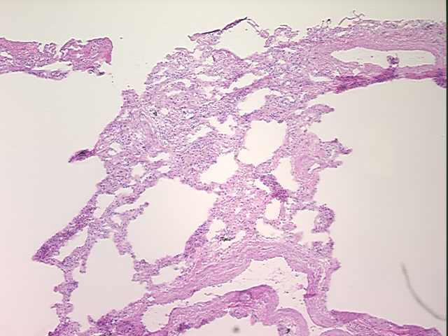 4x Image