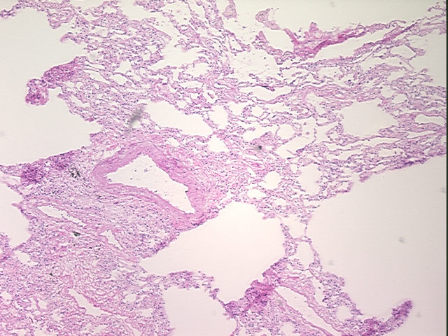 4x Image