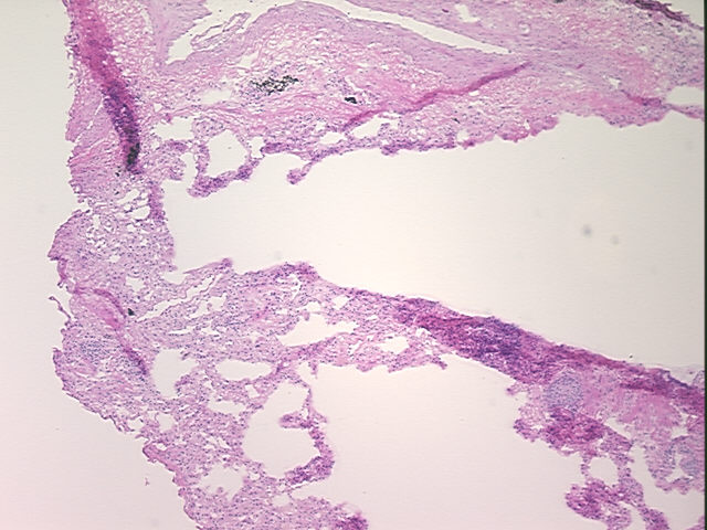 4x Image