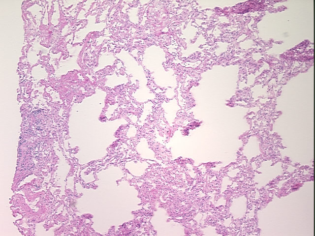 4x Image