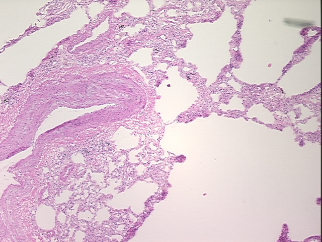 4x Image