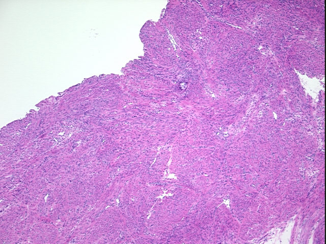 4x Image