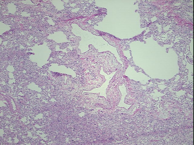 4x Image