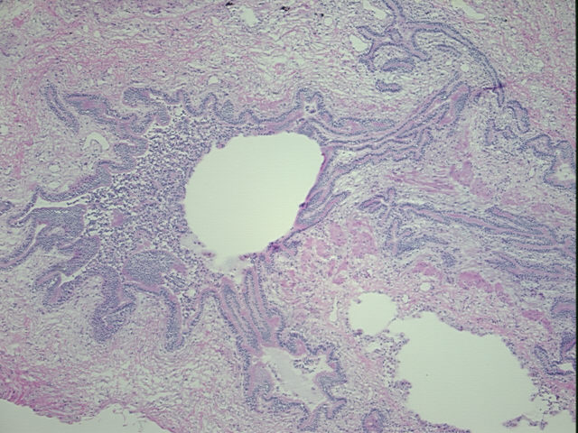 4x Image