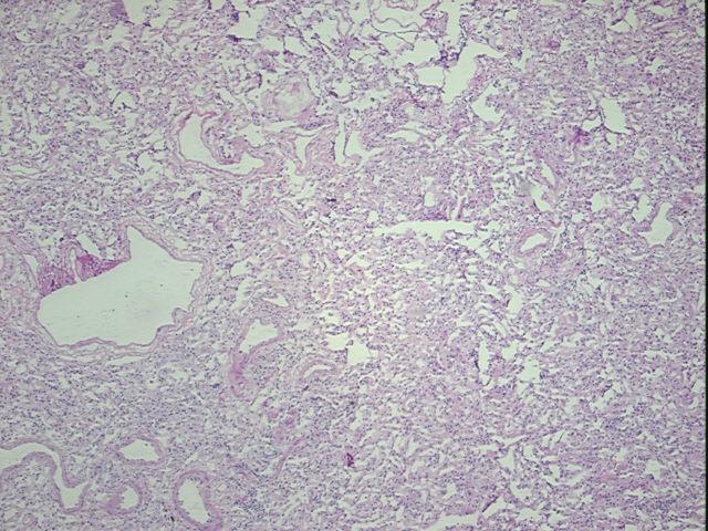 4x Image