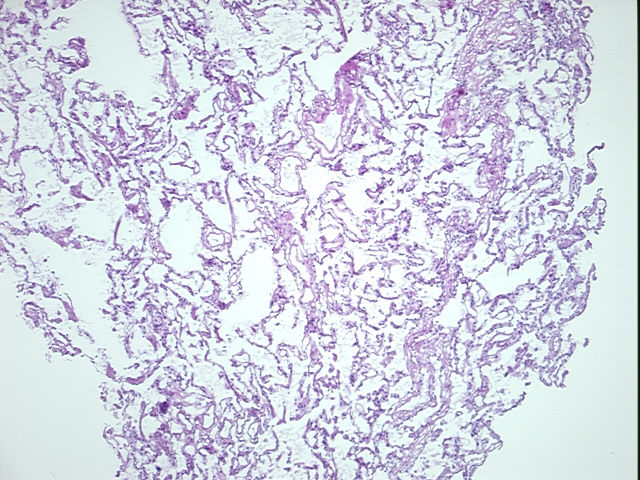 4x Image