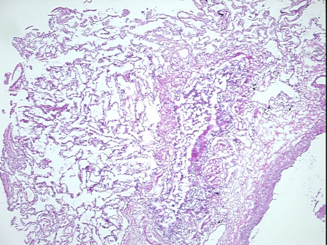 4x Image