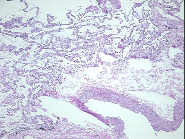 4x Image