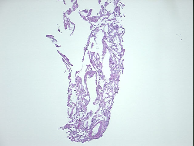 4x Image