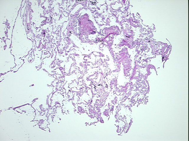 4x Image