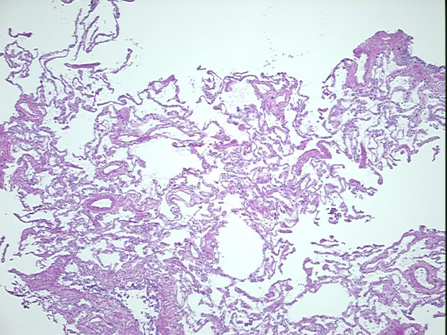 4x Image