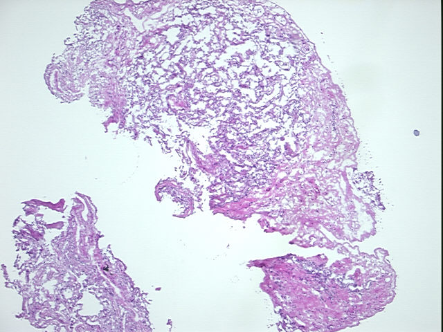 4x Image