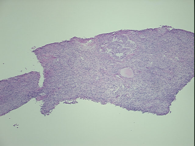 4x Image