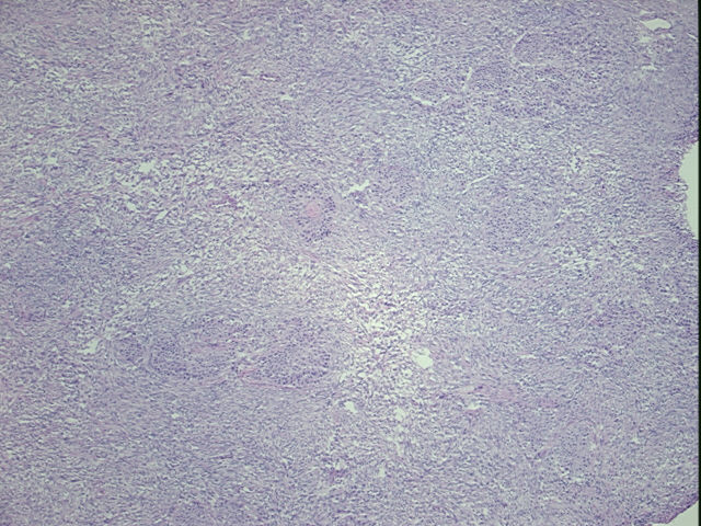 4x Image
