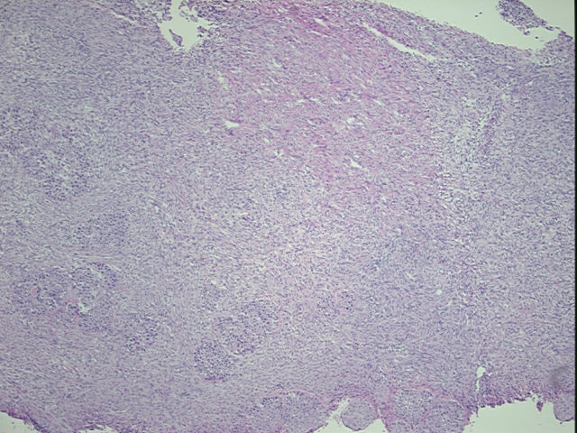 4x Image