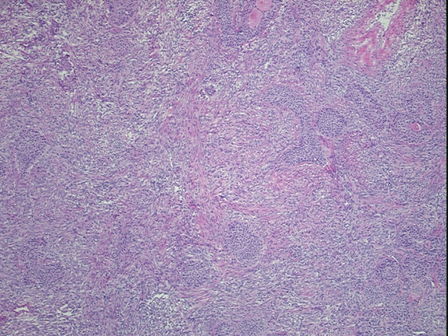 4x Image
