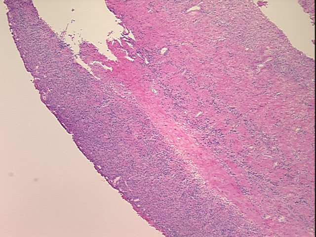 4x Image